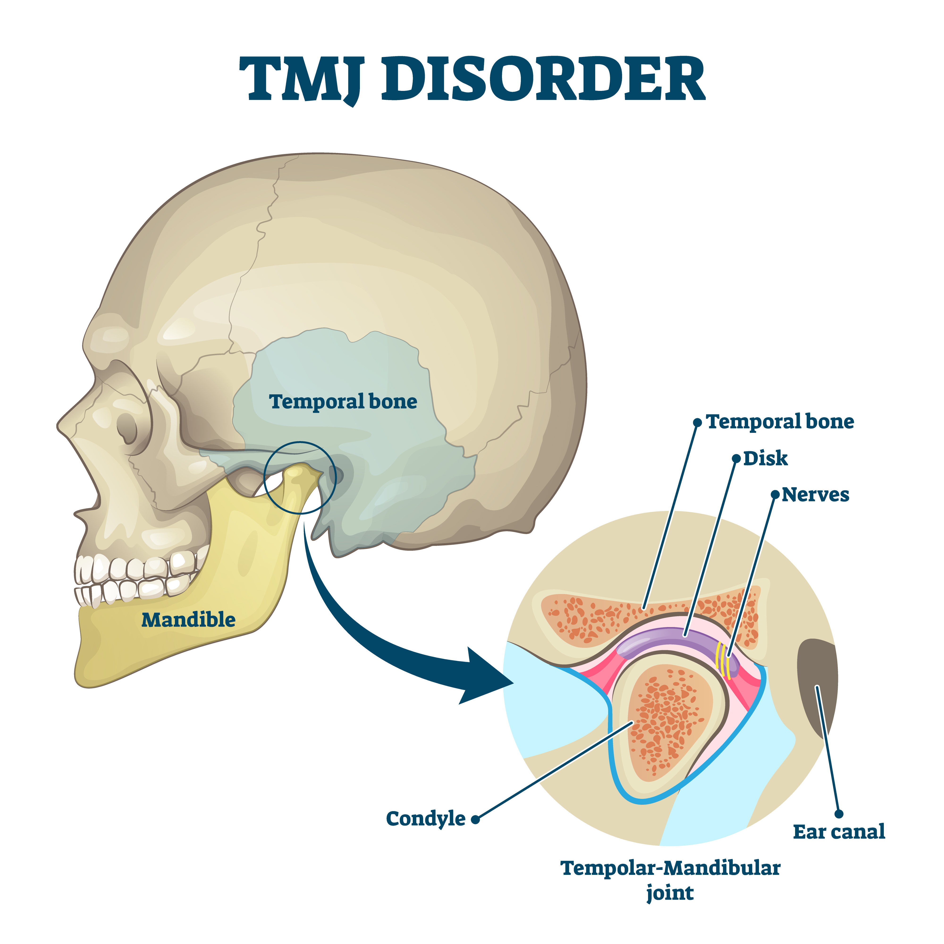TMJ Diagram